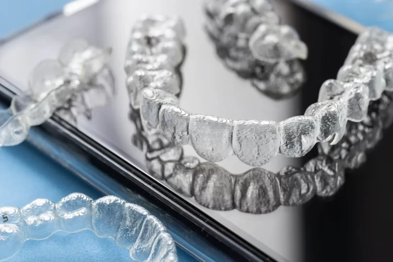 Invisalign Szczecin