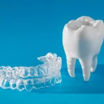 aparat-invisalign-warszawa-1