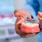 nakladki-invisalign-lublin-1